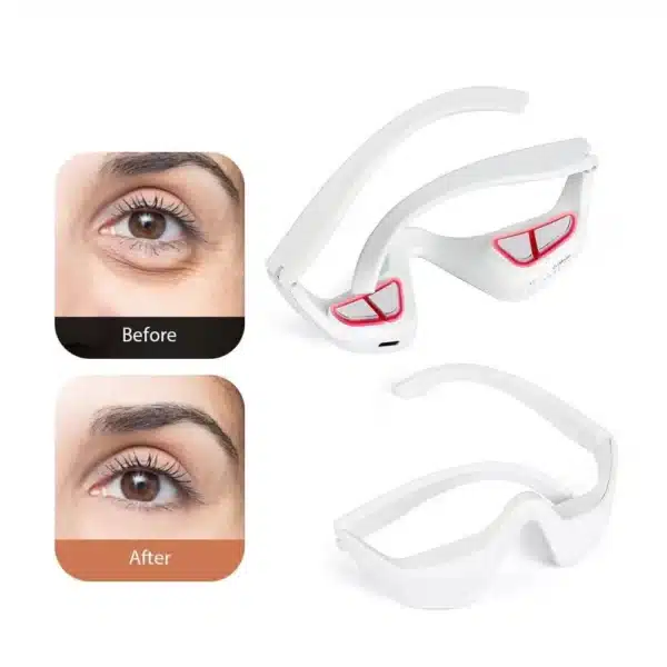 Before and after under-eye results using red light therapy massager for dark circles and puffiness