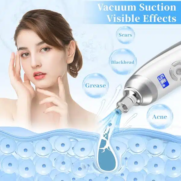Diamond microdermabrasion device demonstrating vacuum suction removing acne, grease, and blackheads